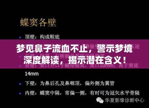 梦见鼻子流血不止,警示梦境深度解读,揭示潜在含义!