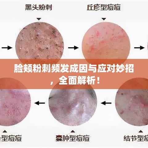 脸颊粉刺频发成因与应对妙招,全面解析!